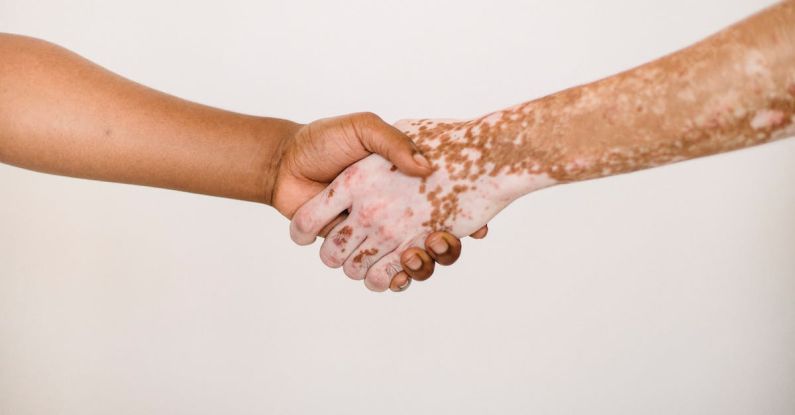 Handshake Promise - Crop anonymous man shaking hand of male friend with vitiligo skin against white background